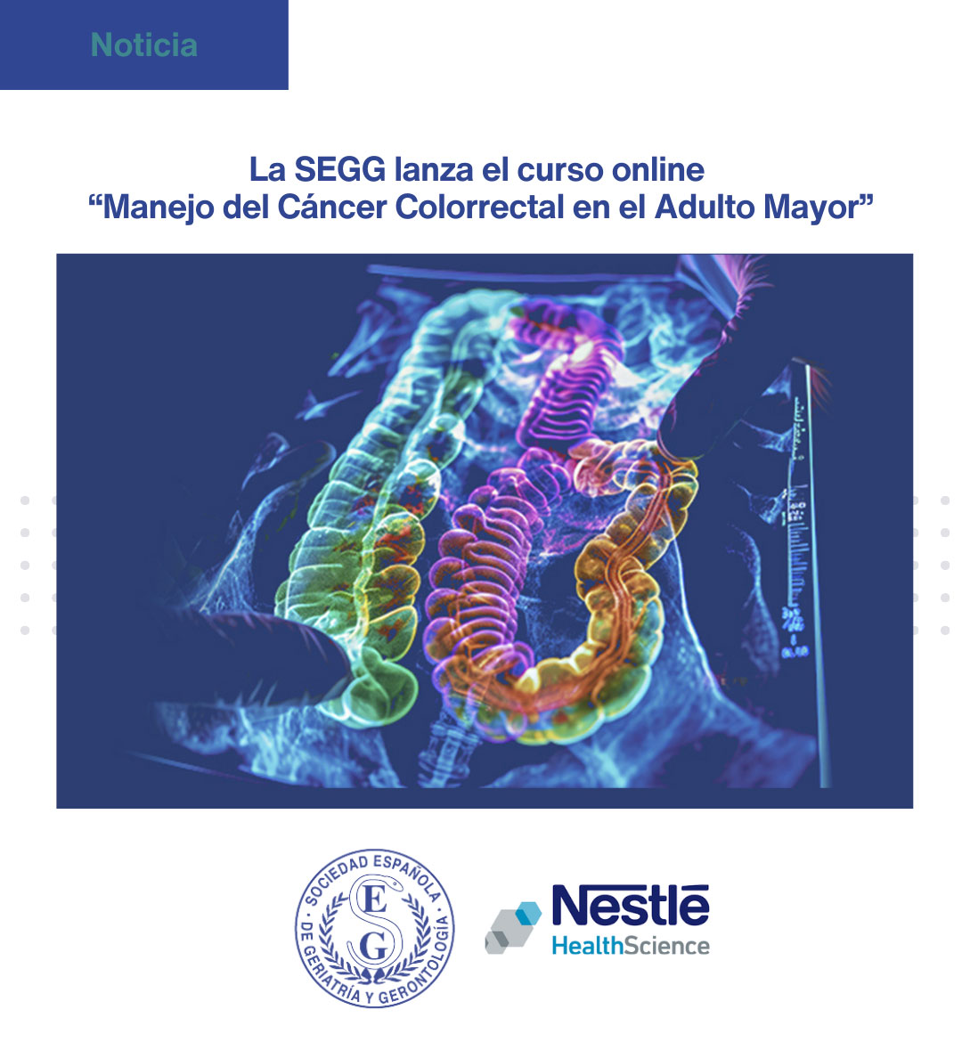 <p>La SEGG lanza el curso online Manejo del Cáncer Colorrectal en el Adulto Mayor</p>